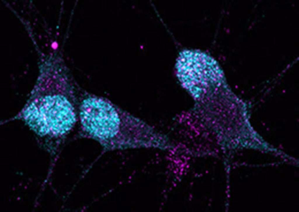 proteinaTDP43