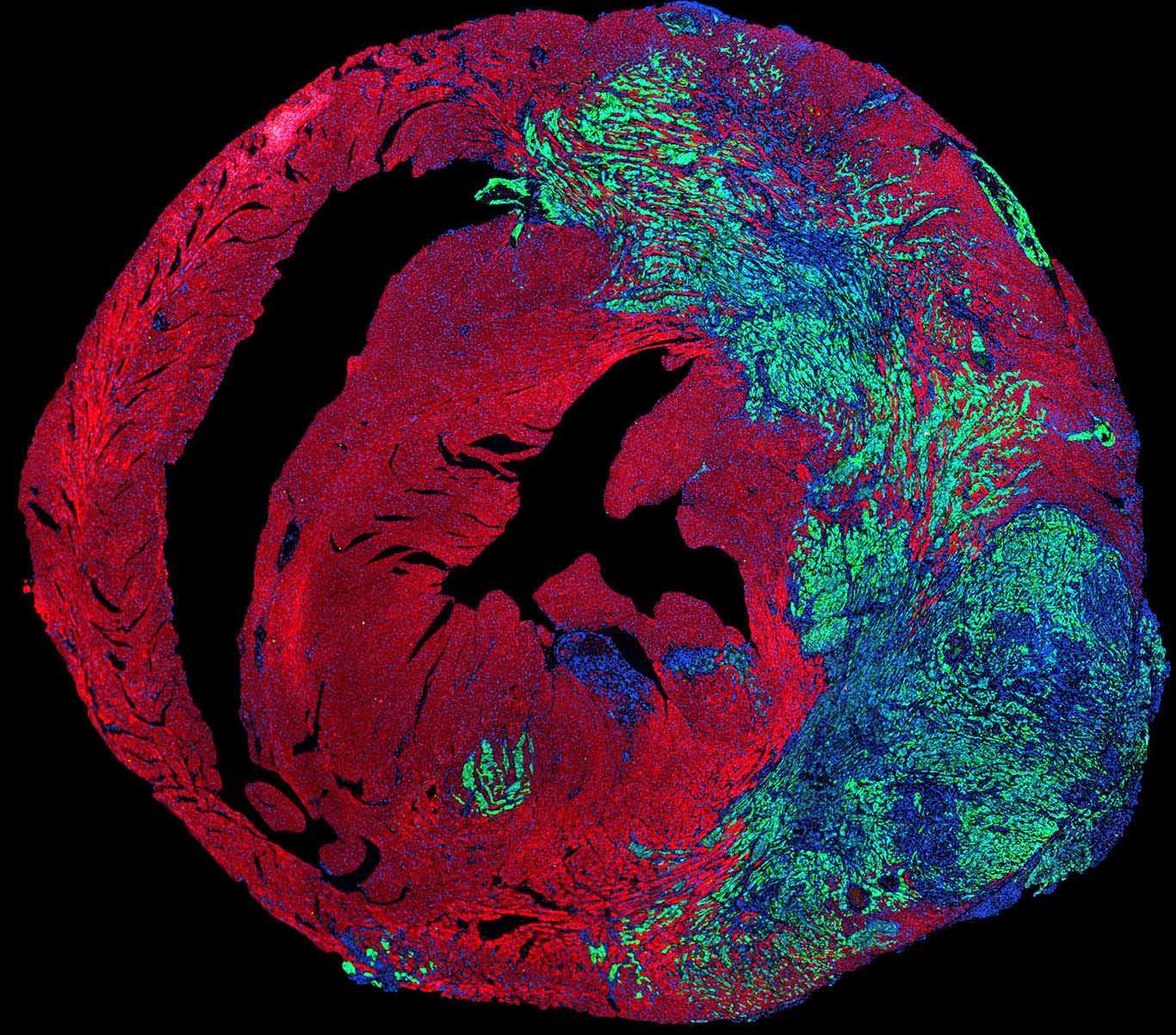 ricerca cuore tumori