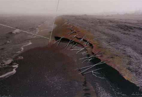 Vascotto Sutura